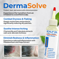 Dermasolve extrait camomille flacon, contact direct avec le cuir chevelu pour le confort.