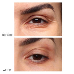 Dermelect Revitalite: applicateur-froid-yeux pour une sensation fraîche lors de l’utilisation