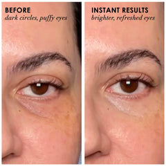 Dermelect Revitalite: creme-yeux-texture-soyeuse pour hydrater et lisser le contour des yeux