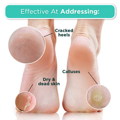 DERMORA Taille universelle adaptée aux pieds jusqu’à 29 cm.