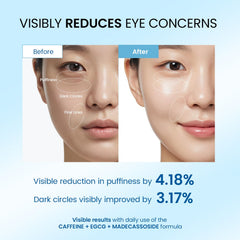 Dongyu Eye Cream morning wake roller for a brighter start to the day.