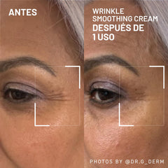 Dr Brandt Needles No More: application frontale ciblée pour lisser les rides.