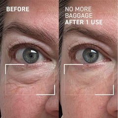 Dr Brandt Needles No More – Filmatrix, seconde peau qui serre légèrement le contour.