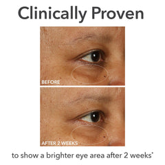 Crème contour des yeux Dr Dennis Gross DermInfusions, application 360°, tapoter autour des yeux.