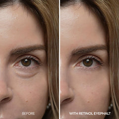 Dr.Melaxin EGF Niacinamide Yeux – Hydratation durable et barrière renforcée.