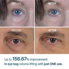 Application sous les yeux avec Crème Eyephalt Eyebag, sensation fraîche.