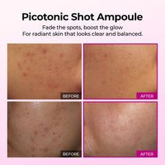 Dr.Melaxin Sérum Calcium Shot : application facile pour uniformiser le teint.