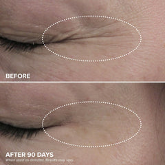 DRMTLGY HPR Contour des yeux, éclat et fraîcheur possibles.