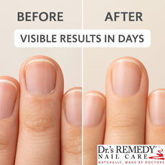 Dr.'s Remedy Caress Cuticle Oil — mains douces et cuticules soignées.