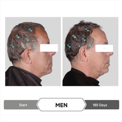 Spectral Extrême: technologie Melanex préserve le pigment pour une couleur uniforme.
