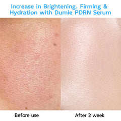 Sérum Dumie niacinamide et glutathion pour teint uniforme et éclat.