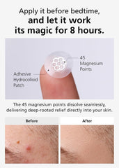 DWEasyDerm Step One Patch applying on breakout provides calming relief and reduced redness.