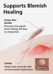 Zoom sur la texture hydrocolloïde du patch, surface douce et transparente.