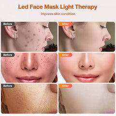 DZAVOK-lumiere-orange-600nm-visage: estompe les rougeurs et uniformise le teint