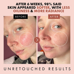 Éclat Skincare tonique rose avec acide hyaluronique et aloé vera pour hydratation.