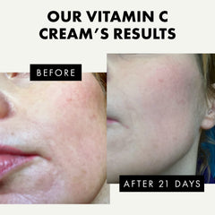 Concentration vitamine C 2,5% dans le produit Eclat, teint uniforme possible.