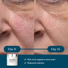 ELEMIS Dynamic Resurfacing Pads — pot 60 cotons pour exfolier en douceur.