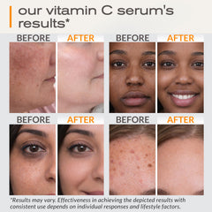Ella & Eden Sérum vitamine C – texture soyeuse pour peau douce.