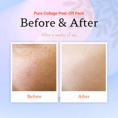 ELT Pure Collagen Peel-Off Masque Elastique Renforcée améliore l’élasticité et fermeté
