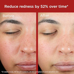 EltaMD UV Skin Recovery Green Tint – Réduction des rougeurs perçue lors de l’application