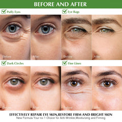 Patchs yeux Enaskin Naturals, hydratation profonde pour le contour des yeux.