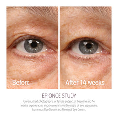Emballage Renewal Eye Cream Epionce, soin quotidien du regard.