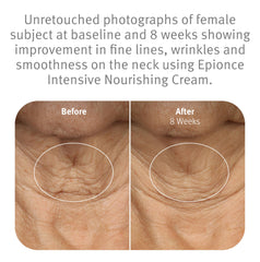 Epionce Intensive Nourishing Cream, ceramides incluses pour renforcer la barrière cutanée.