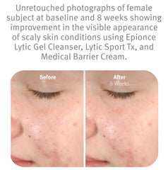 Epionce Lytic Gel Nettoyant – application mains humides, dissout maquillage et impuretés.