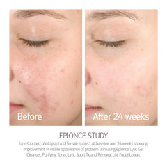 Epionce Renewal Lite Lotion : application matin, peau prête à la journée