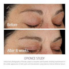 Étiquette Emballage Epionce Defense Intense, présentation professionnelle et soin dermatologique.