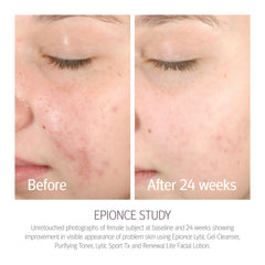 Epionce Tonique Purifiant visage net et frais après l’utilisation.