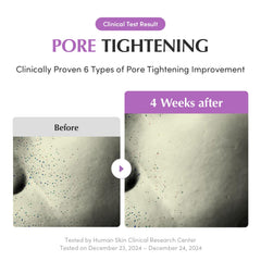 Pores raffermis et peau plus lisse grâce au sérum ciblé.