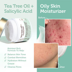Texture mate de Era Organics Tea Tree, peau grasse maîtrisée.