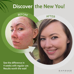 Exposed Skin Care tonique avec extrait thé vert pour anti-oxydants