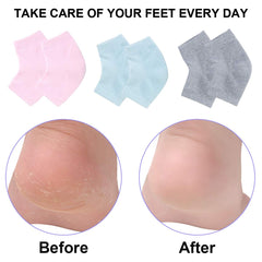 Exptolii chaussettes gel talons usage quotidien pour hydrater les pieds.