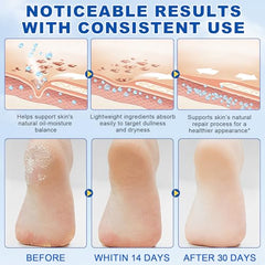 FEISIDUNWSF Crème Pieds 60% Urée, texture non gras qui adoucit callosités