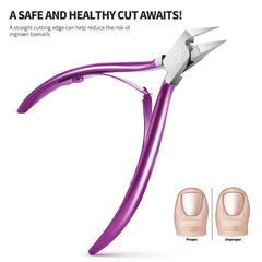FERYES clip-ongle épais, ouverture 70 mm pour facilité de coupe.