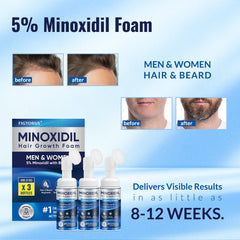 Figtorus Mousse Minoxidil : texture légère et séchage rapide.