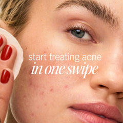 First Aid Beauty Acne Pads visage sans alcool, douceur pour peaux sensibles.
