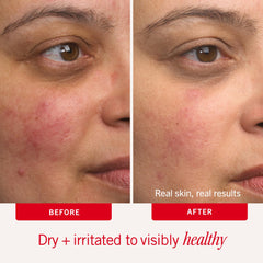 Ultra Repair Cream – céramides renforçant la barrière cutanée.