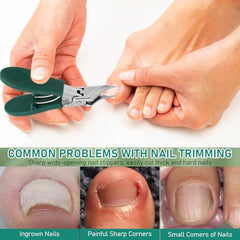Fiyadwzh lame biseatee – coupe-ongles précise évite les bords irréguliers