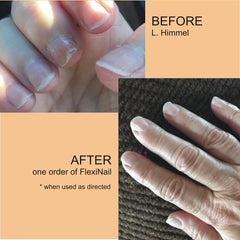 FlexiNail application quotidienne en 25 secondes, pratique et rapide pour vos ongles.