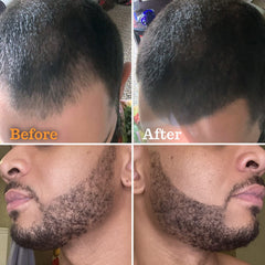 Rendu naturel procuré par Follicle Booster sur barbe