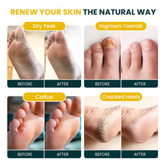 Foot Cure huile de coco bio et agrumes pour nourrir la peau.
