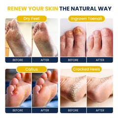Foot Cure ingrédients-epsom-sels-mer: action purifiante pour une peau nette.