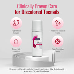 Footlogix Nail Tincture Spray Spiraleen – applicateur facilitant l’application sur les ongles.