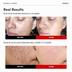 FRANKLY Retinol 0,1% crème — texture soyeuse pour une application en douceur.