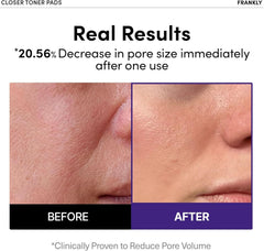 FRANKLY gelee riz 9 peptides – texture nourrissante et rafraichissante.