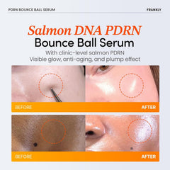 Activation-balle orange FRANKLY PDRN libération des actifs