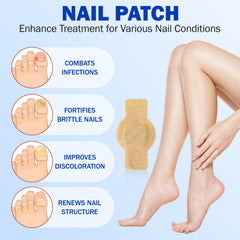 Patch Frovetani pour ongle coloration, amélioration visuelle possible